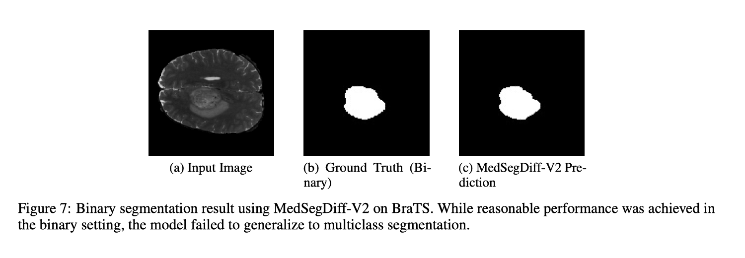 MedSegDiff-V2 binary segmentation result from Figure 7.