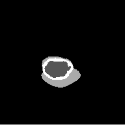 Diffusion ground-truth mask.