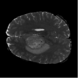 Diffusion input MRI slice.