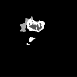 FNO ground-truth mask.