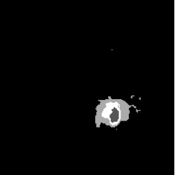 FNO-Diffusion prediction mask.